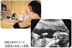 理科5年_p47_母親の体内のようす