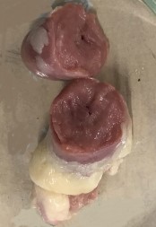 (3)心臓の横断面